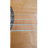 Outlet B03 - Antonio De Toledo Modelo E15 Cedro CEQ Fishman Con Cutaway AT-15CE Cut con Puente Reparado y Alguna Marca De Uso