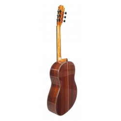 Outlet B07 - Antonio De Toledo AT-15C – Guitarra Clasica con Tapa Maciza de Cedro y Fondo y Aros de Palosanto con Marcas De Uso