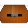 Outlet B07 - Antonio De Toledo AT-15C – Guitarra Clasica con Tapa Maciza de Cedro y Fondo y Aros de Palosanto con Marcas De Uso